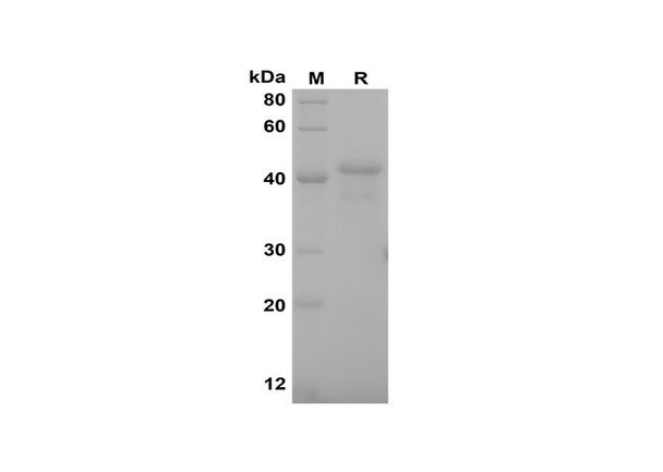 Recombinant Rat M-CSF Protein(Sumo Tag) (RPES8248)