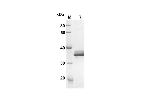 Recombinant Human IGFBP2 Protein (His Tag) (RPES8292)