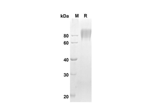 Recombinant Human CD86 Protein (Fc Tag) (RPES8302)