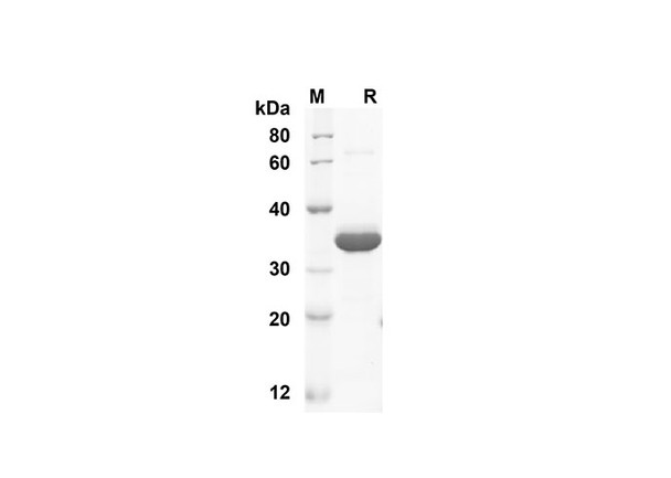 Recombinant Human Fc Protein ( Fc Tag) (RPES8329)