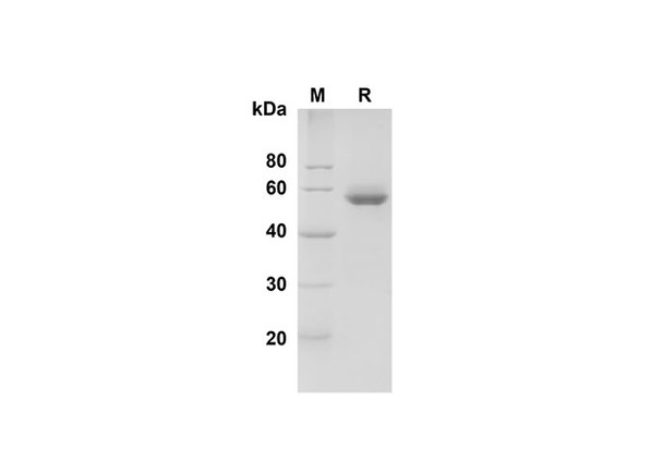 Recombinant Human BLAME/SLAMF8 Protein (Fc Tag) (RPES8334)