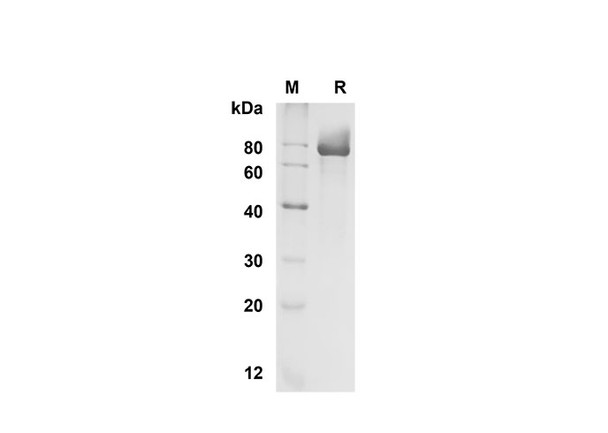 Recombinant Human Fetuin B Protein (Fc Tag) (RPES8342)