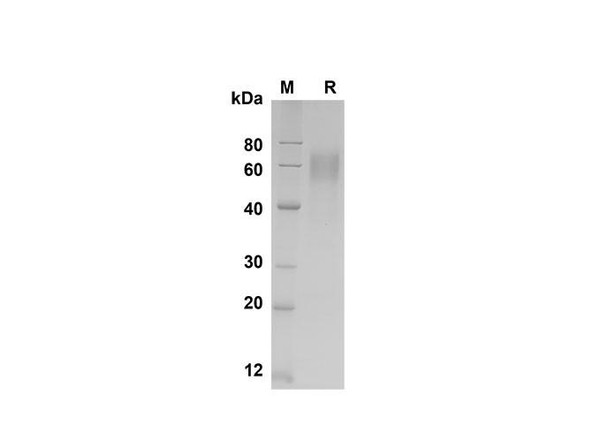Recombinant Human IL-18 BPa Protein (Fc Tag) (RPES8352)