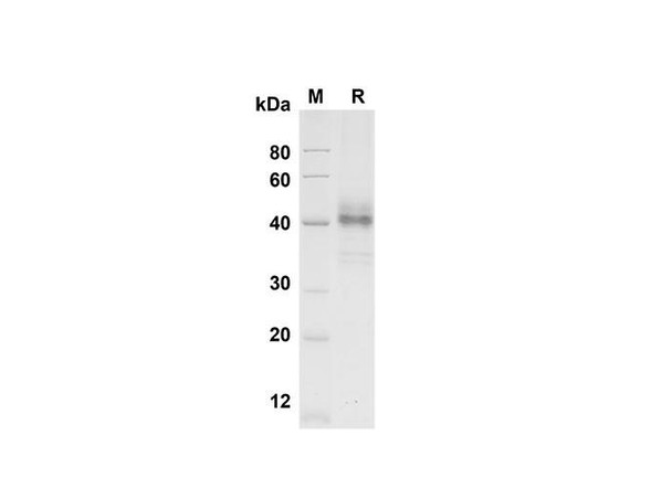 Recombinant Human Cripto-1 Protein (Fc Tag) (RPES8353)