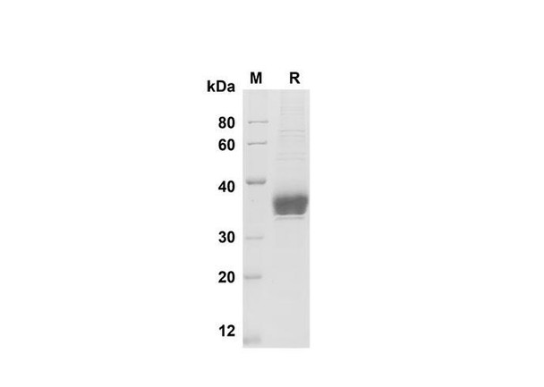 Recombinant Human EpCAM/TROP-1 Protein (His Tag) (RPES8355)