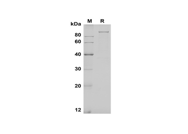 Recombinant Human GAS6 Protein (Fc Tag) (RPES8372)