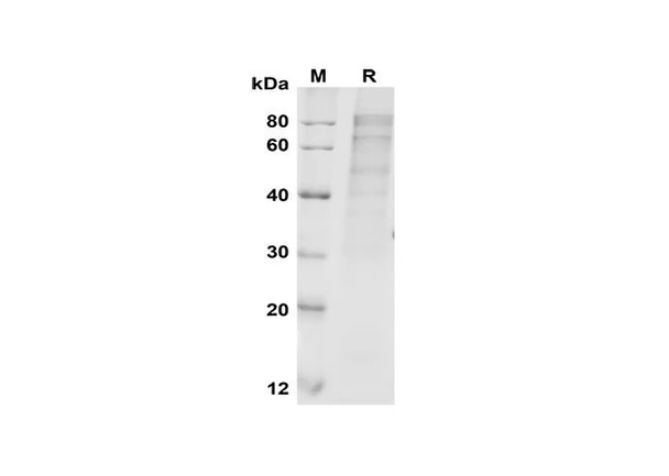 Recombinant Human FURIN Protein (His Tag) (RPES8373)