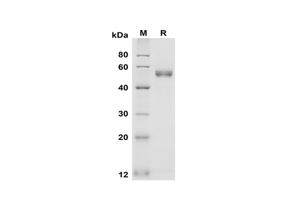 Recombinant Human FcÎ³ RIIA/CD32a Protein (Fc Tag) (RPES8376)