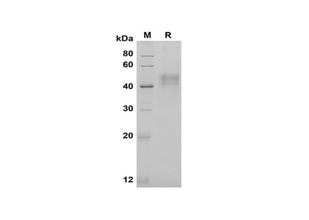 Recombinant Human Pentraxin 3/TSG-14 Protein (His Tag) (RPES8387)