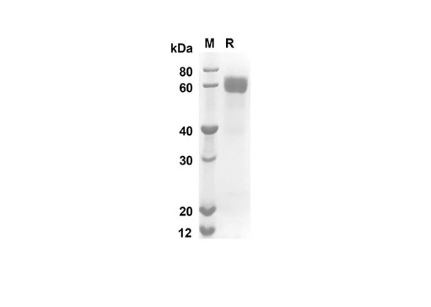 Recombinant Mouse CD23 Protein (FC Tag) (RPES8398)