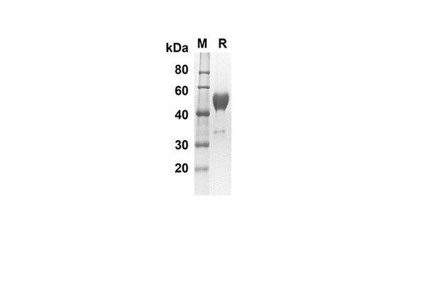 Recombinant Mouse CTLA-4/CD152 Protein (Fc Tag) (RPES8401)