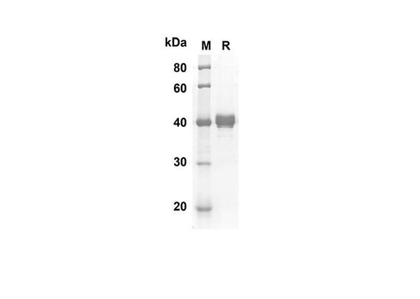 Recombinant Mouse GITR Ligand/TNFSF18 Protein (Fc Tag) (RPES8410)