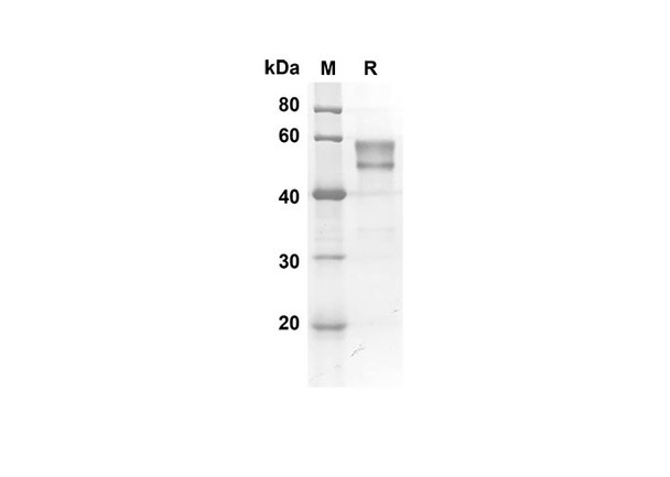 Recombinant Mouse HVEM/TNFRSF14 Protein (Fc Tag) (RPES8411)
