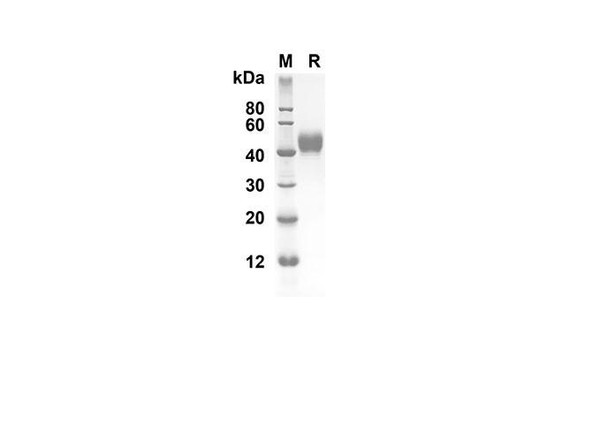Recombinant Mouse IL-5 Protein (Fc Tag) (RPES8416)