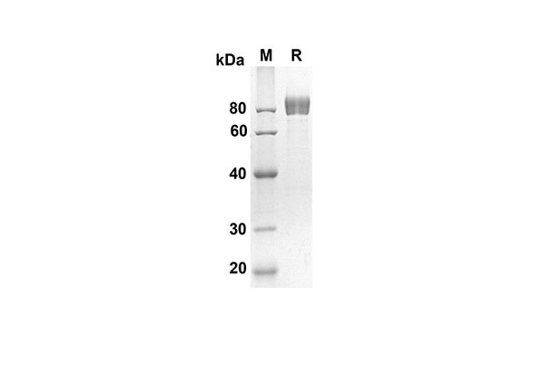 Recombinant Mouse gp130 Protein (His Tag) (RPES8423)