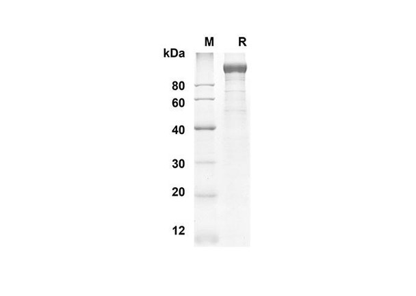 Recombinant Mouse LEPR Protein (His Tag) (RPES8443)