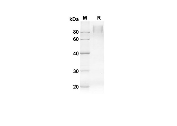 Recombinant Mouse Csf1r Protein (His Tag) (RPES8445)