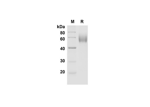 Recombinant Mouse CD30 Ligand/TNFSF8 Protein (Fc Tag) (RPES8462)