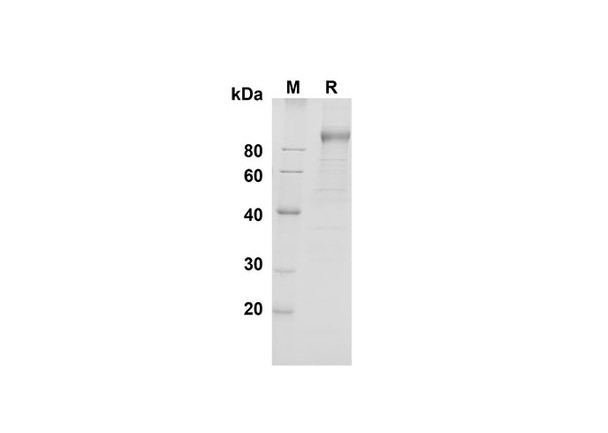 Recombinant Mouse DPPIV/CD26 Protein (His Tag) (RPES8476)