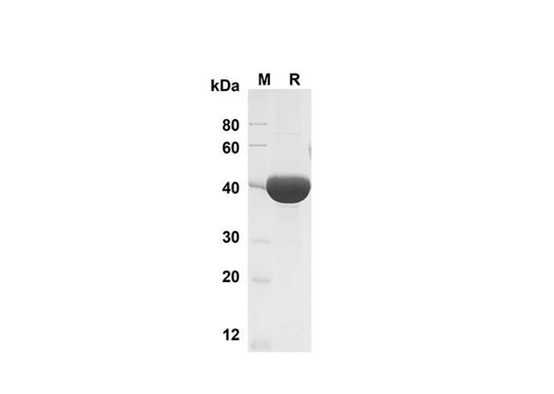 Recombinant Mouse Chitinase 3-like 1 Protein (His Tag) (RPES8478)