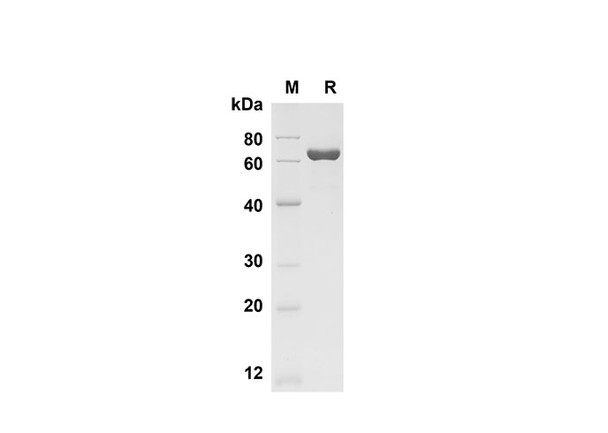 Recombinant Mouse Chitinase 3-like 1 Protein (Fc Tag) (RPES8479)