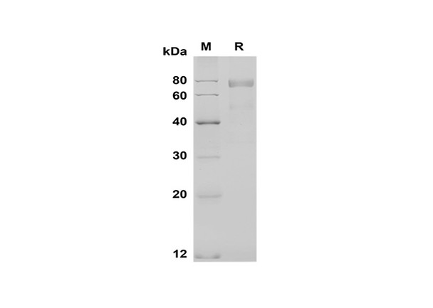 Recombinant Mouse NOV/CCN3 Protein (Fc Tag) (RPES8495)