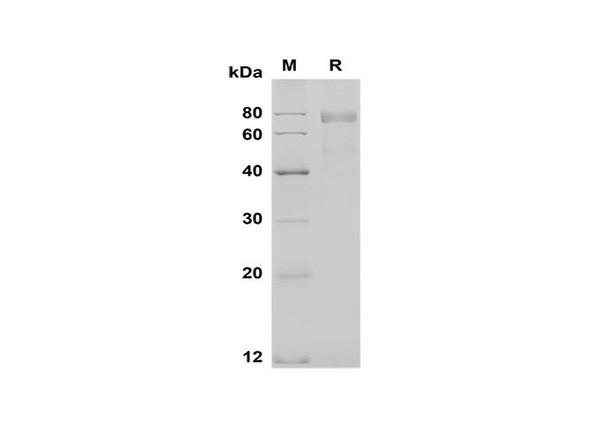 Recombinant Mouse NOV/CCN3 Protein (Fc Tag) (RPES8495)