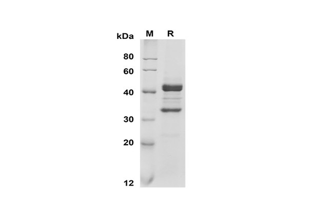 Recombinant Mouse APRIL/TNFSF13 Protein (Fc Tag) (RPES8505)