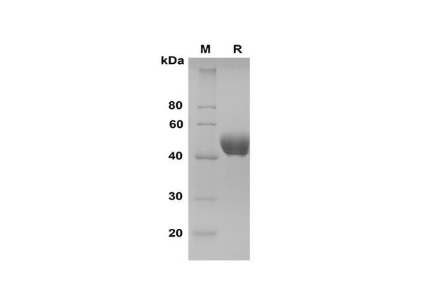 Recombinant Rat Serpin E1/PAI-1 Protein (His Tag) (RPES8536)