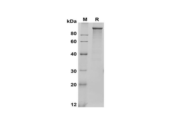 Recombinant Rat LDLR Protein (His Tag) (RPES8542)