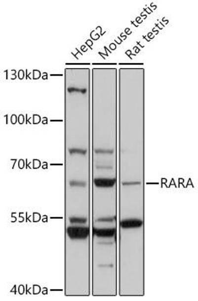 Anti-RARA Antibody (CAB0370)