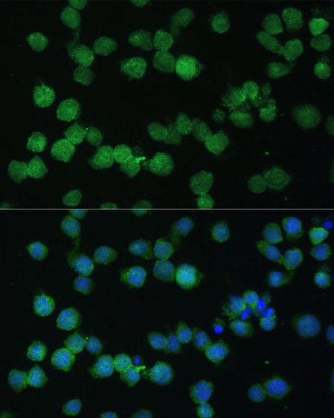 Anti-CR1 Antibody (CAB10059)