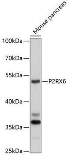 Anti-P2RX6 Antibody (CAB10131)
