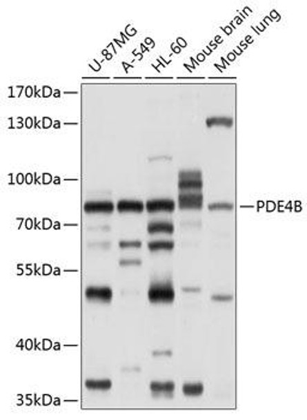 Anti-PDE4B Antibody (CAB10196)
