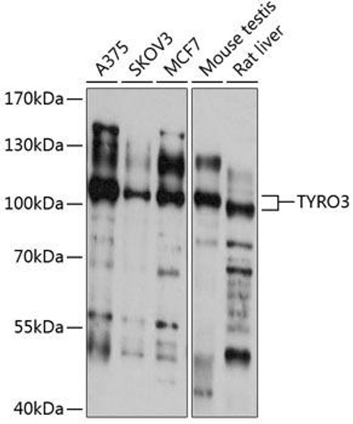 Anti-TYRO3 Antibody (CAB12241)