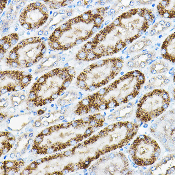 Anti-ALPL Antibody (CAB12396)