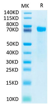 Biotinylated Recombinant Human Notch 2 Protein (RPCB0044)