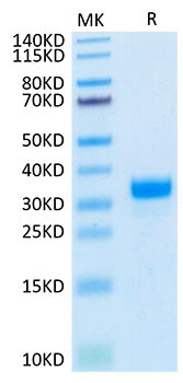 Biotinylated Recombinant Human Angiopoietin-2/ANG-2/ANGPT2 (275-496) Protein (RPCB0047)