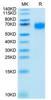 Biotinylated Recombinant Human IL-2RG/CD132 Protein (RPCB0082)