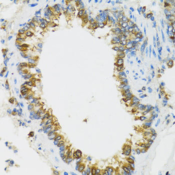 Anti-PI3 Antibody (CAB12482)