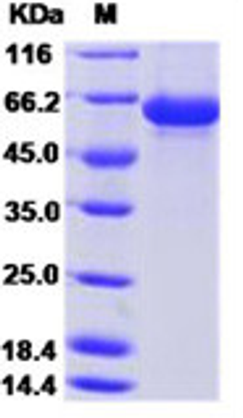 Recombinant Influenza A H1N1 (A/Puerto Rico/8/1934) Hemagglutinin / HA Protein (RPCB0101)