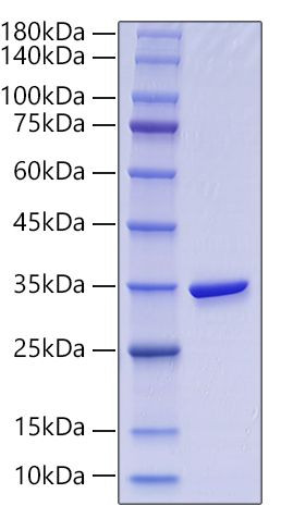 Recombinant Human Gamma-glutamyl hydrolase/GGH Protein (RPCB0111)