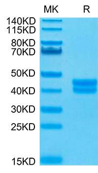 Biotinylated Recombinant Human Cell surface A33 antigen/GPA33 Protein (RPCB0124)