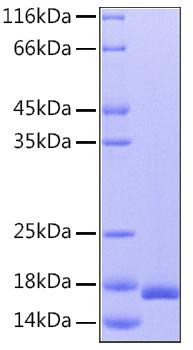 Recombinant Human IL-36Ra/IL-1F5 Protein (RPCB0134)