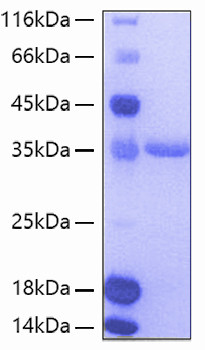 Recombinant Human TIE2/TEK/CD202b Protein (RPCB0135)