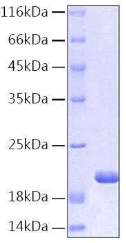 Recombinant Human IL-1RN Protein (RPCB0144)