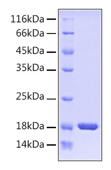 Recombinant Human PIN1 Protein (RPCB0155)