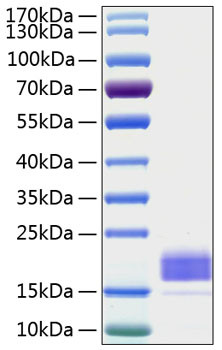 Recombinant Human TIGIT Protein (RPCB0187)