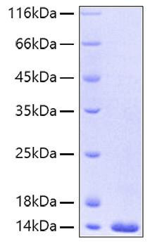 Recombinant Human FABP4/A-FABP/ALBP(A29T) Protein (RPCB0198)