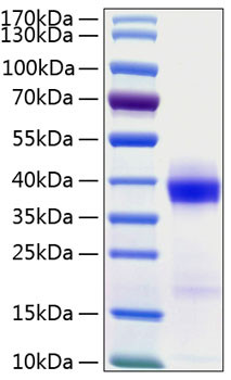 Recombinant Human B7-H1/PD-L1/CD274 Protein (RPCB0209)